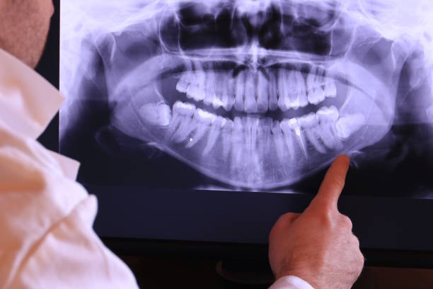 Best Emergency Tooth Extraction in Curtisville, PA